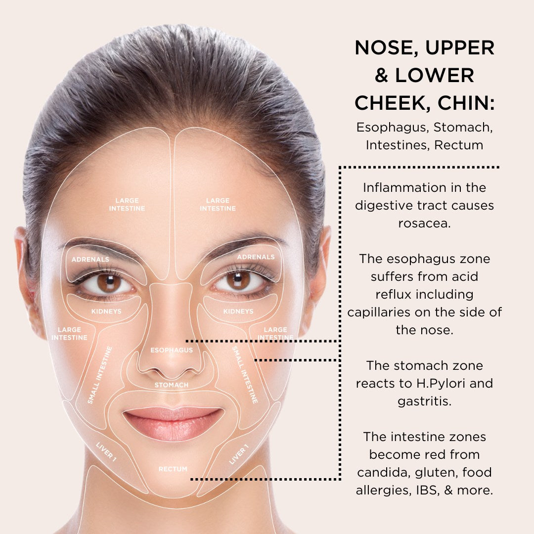 infograph of osmosis skin mapping for nose, upper and lower cheeks and chin with text