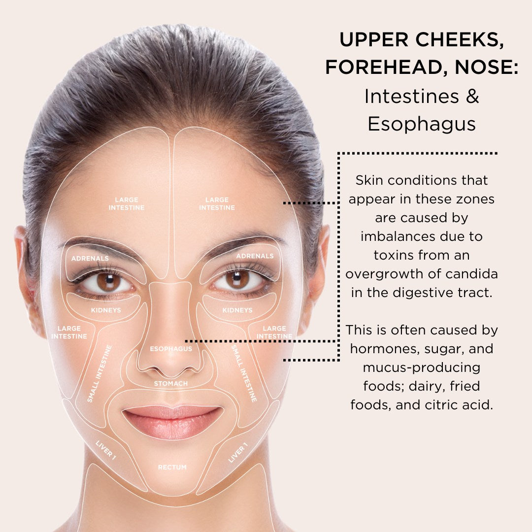 infograph of osmosis skin mapping for upper cheeks, forehead and nose with text